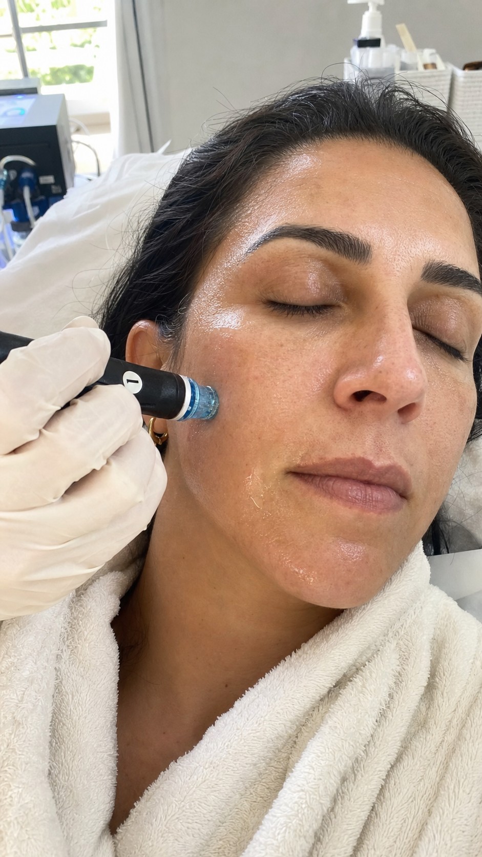 טיפול HydraFacial בקליניקה